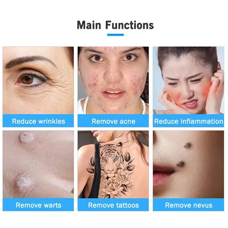 Ozone Plasma Pen Wart Freckle Removal Fibroblast Pen Skin Mole Dark Spot Remover Face Lifting Dot Wrinkle Eyelid Lift