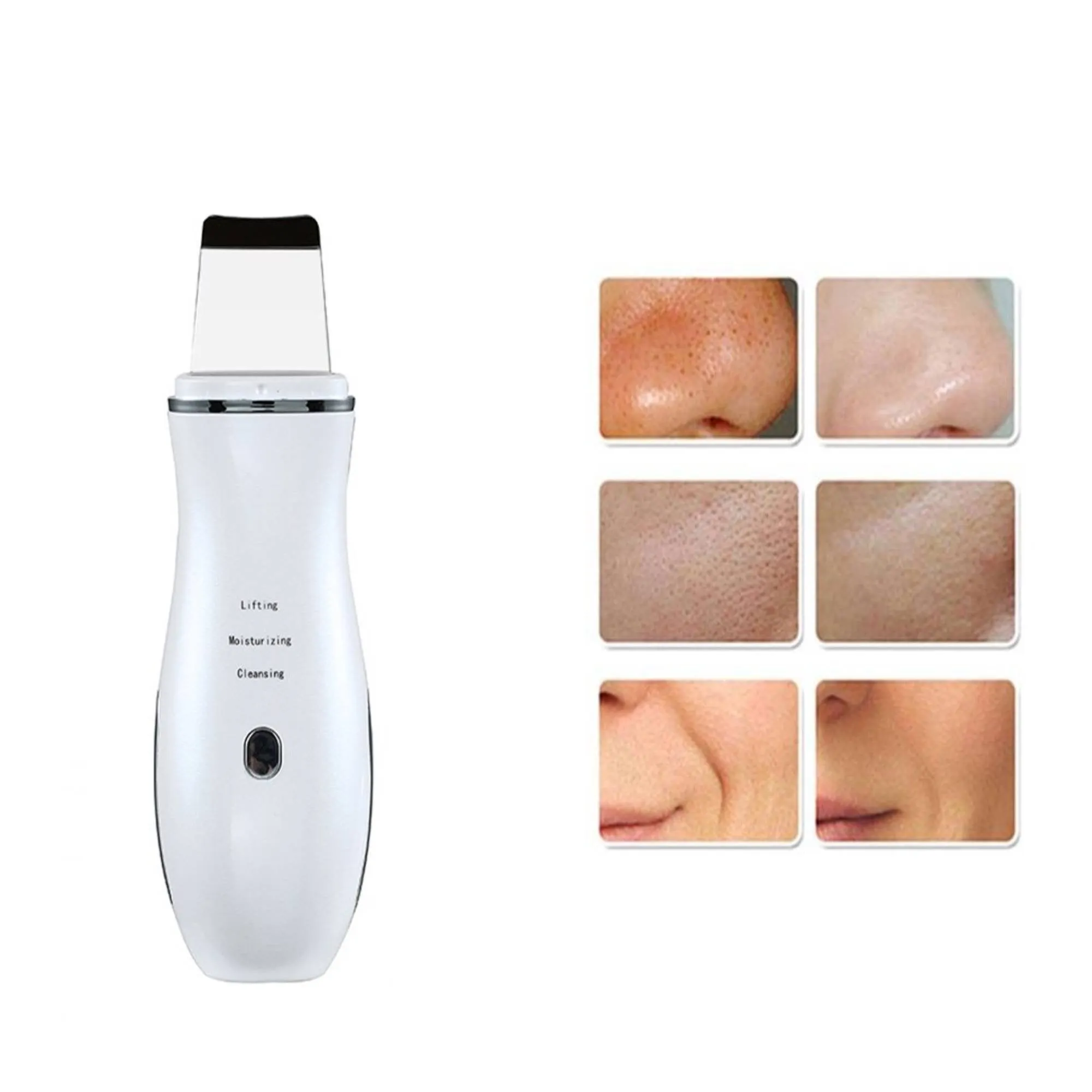 Ultrasonic Skin Scrubber and Blackhead Remover